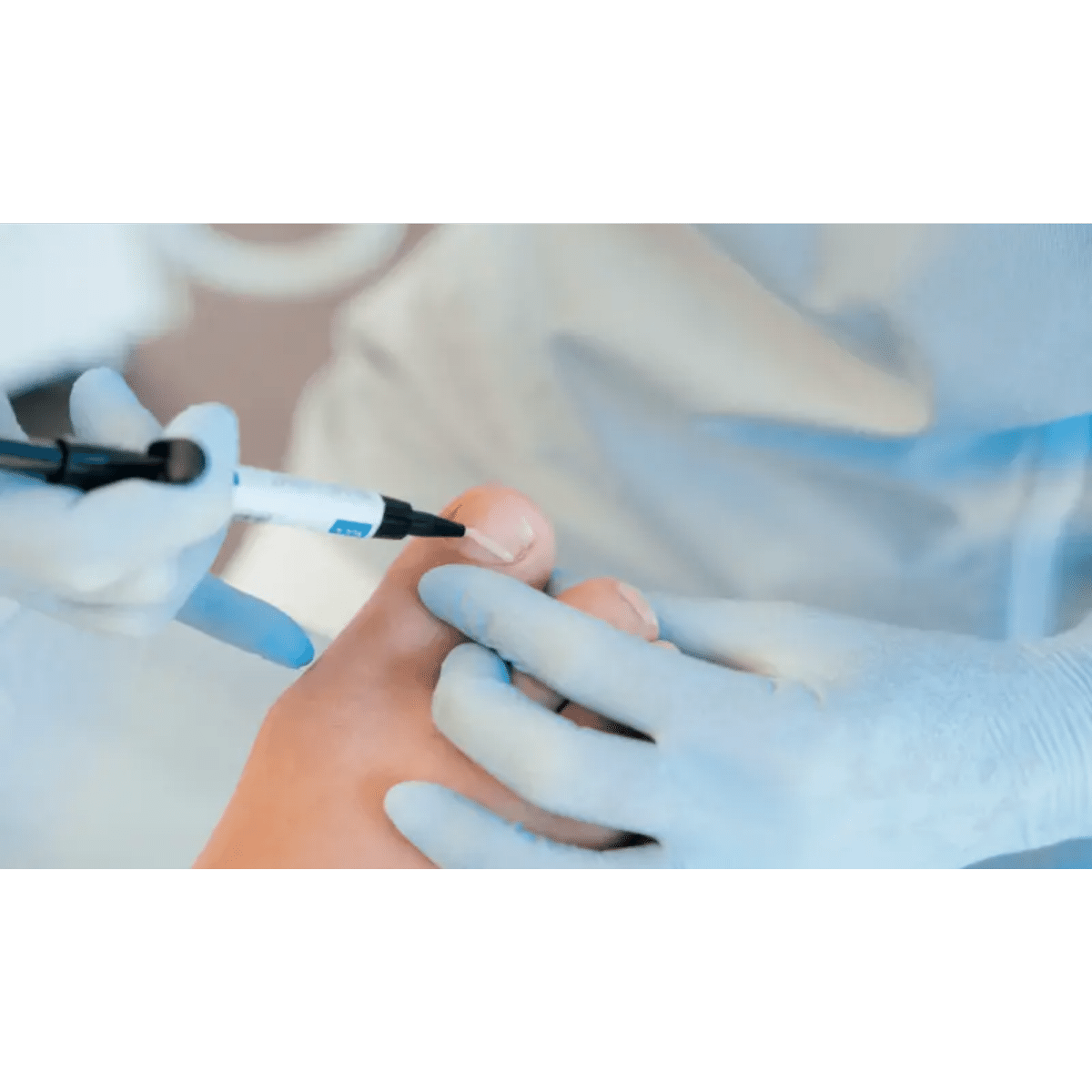 BLUE LIGHT početni set