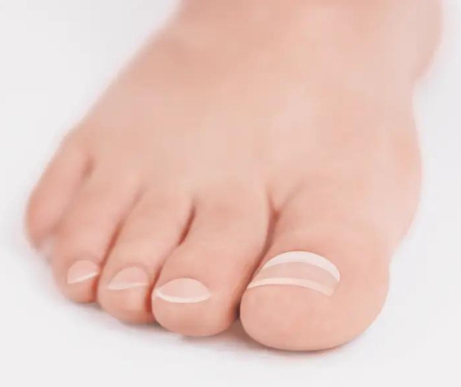 BLUE LIGHT gel - 3 g / RUCK®